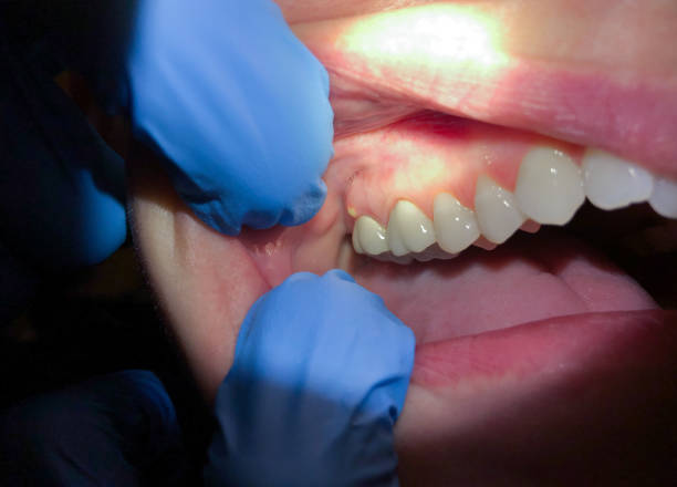 Best Urgent Dental Care for Toothaches in Oxford, MI