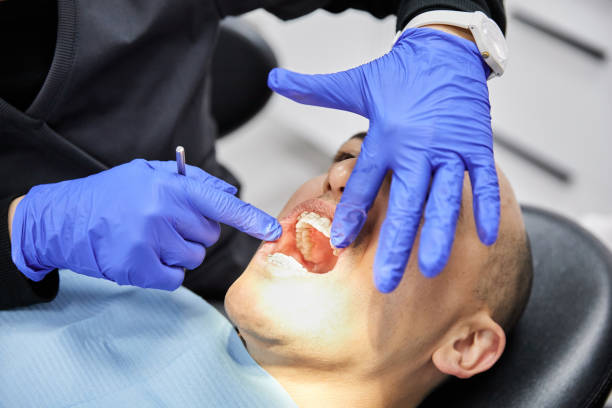 Best Emergency Wisdom Tooth Extraction in Oxford, MI